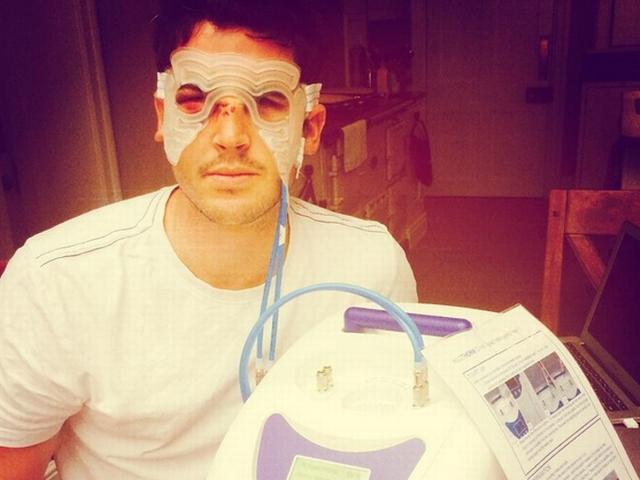 कीसवेटर की आंख का ऑपरेशन होगा Craig Kieswetter_eye