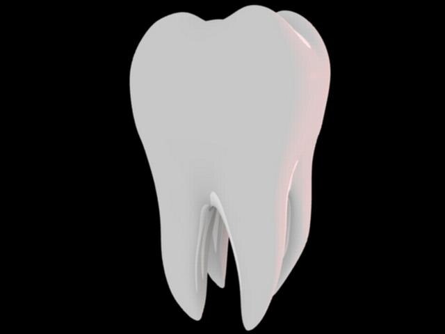डॉक्टरों ने युवक के मुंह से निकाले 232 दांत! 232 tooth