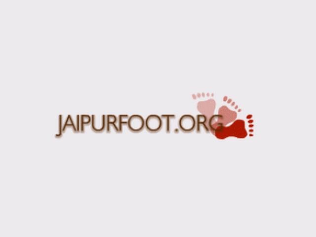 ‘जयपुर फुट’ के बाद अब ‘जयपुर हैंड’ प्रशंसनीय _jaipoor foot _jaipoor hand _margreat alva