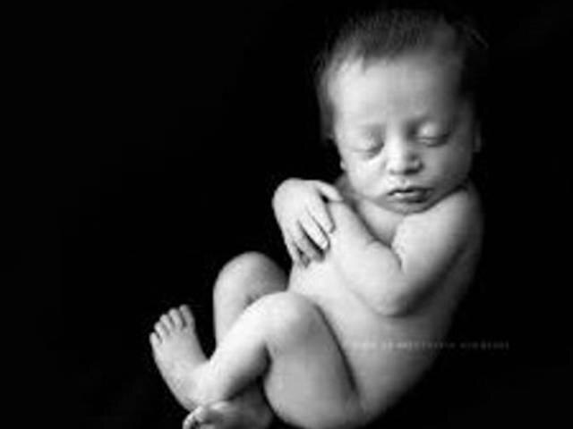 36 साल बाद 60 वर्षीय महिला के पेट से निकला अजन्मे बच्चे का कंकाल Unborn Baby’s Skeleton Removed from Woman’s Womb After 36 Years