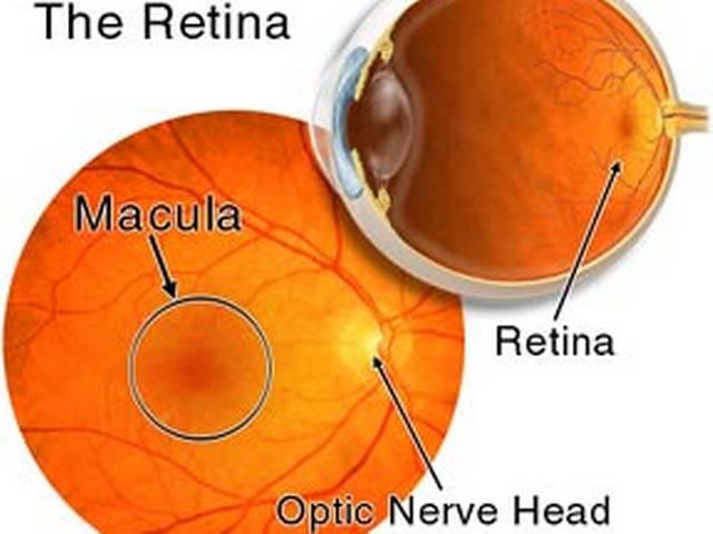 जापान में हुआ रेटिना का सफल ट्रांसप्लांट retina transplant