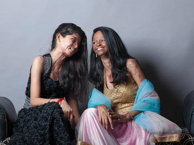 आगरा में तेजाब हमला पीड़िताओं ने खोला कैफे acid attack victims open cafe in the city of love, agra