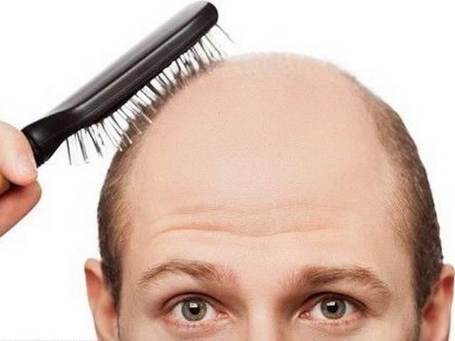 अब स्टेम कोशिकाओं से उग सकेंगे बाल Human stem cells generate new hair in lab