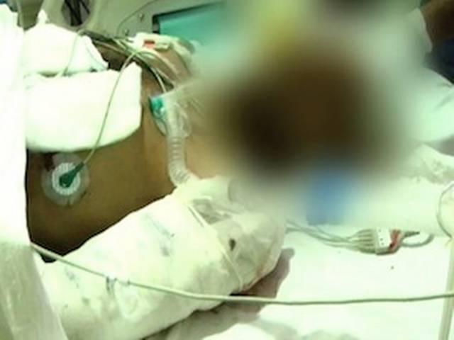 भोपाल में क्रूरता, कार से घसीटे गए युवक की मौत भोपाल में क्रूरता, कार से घसीटे गए युवक की मौत