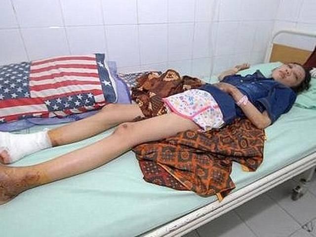 शर्मनाक! 'मालकिन ने नौकरानी पर किया ऐसा अत्याचार कि...' WOMEN_tortured_ maid_vacuum cleaner_naked_soaked_cold water_shocked_Hong Kong