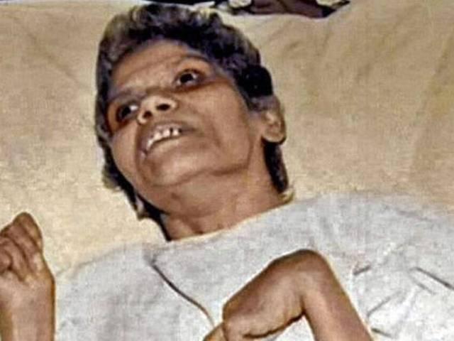नर्स अरुणा को 42 साल तक मौत देने वाला मिला, ABP से कहा- 'मुझे पछतावा, बहुत पछतावा है' aruna_shabagh_Culprit