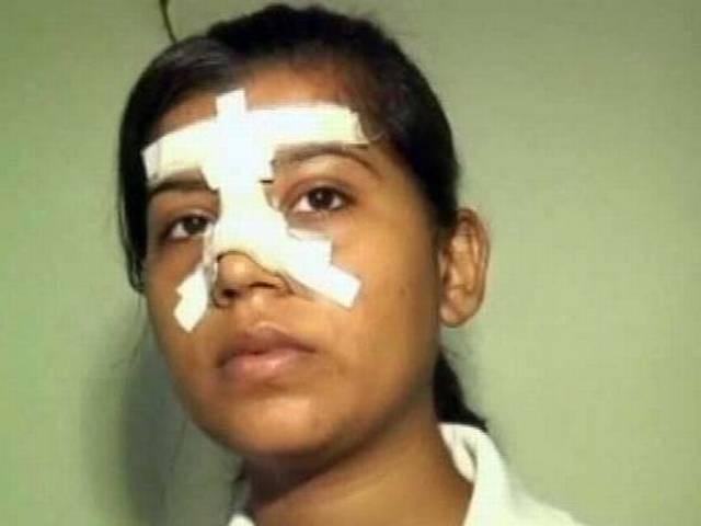 राष्ट्रीय कबडडी खिलाड़ी के साथ मारपीट, छेड़छाड़ national level woman Kabaddi player was beaten