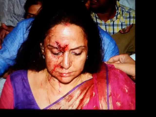 हेमा की कार का एक्सीडेंट, एक बच्ची की मौत, 4 जख्मी hema malini