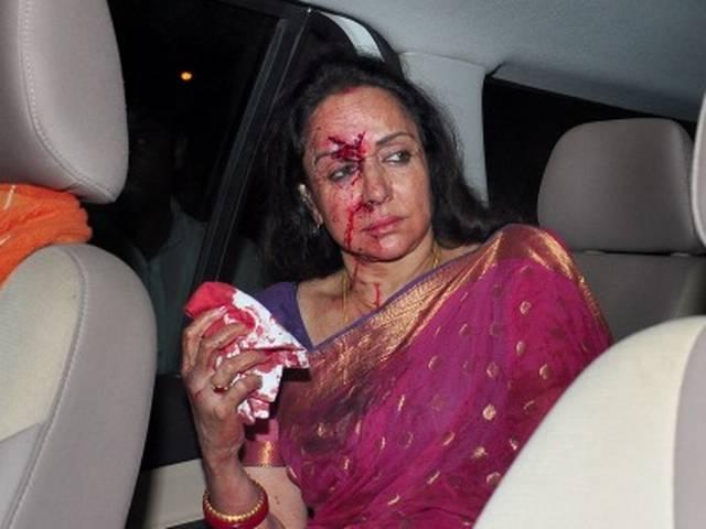 हेमा मालिनी का ड्राइवर जमानत पर रिहा Hema Malini_