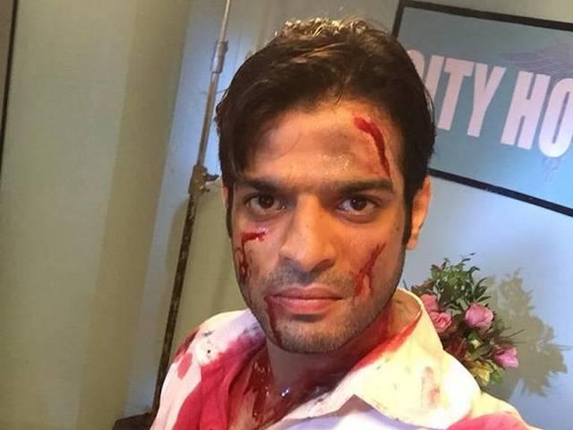 'ये हैं मोहब्बतें' के सेट पर घायल हुए करन पटेल Karan Patel injured on ‘Yeh Hai Mohabbatein’ sets