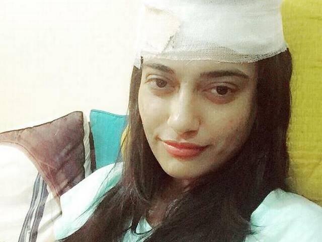 सिर में 6 टांकों के साथ काम पर लौटीं अभिनेत्री सुरभि ज्योति surabhi_is_back