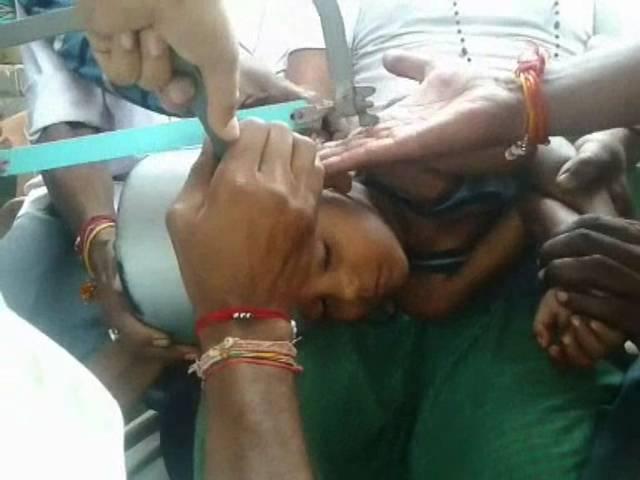 VIRAL VIDEO: प्रेशर कुकर में फंसा सात साल के बच्चे का सिर 5-year-old child gets his head stuck in pressure cooker