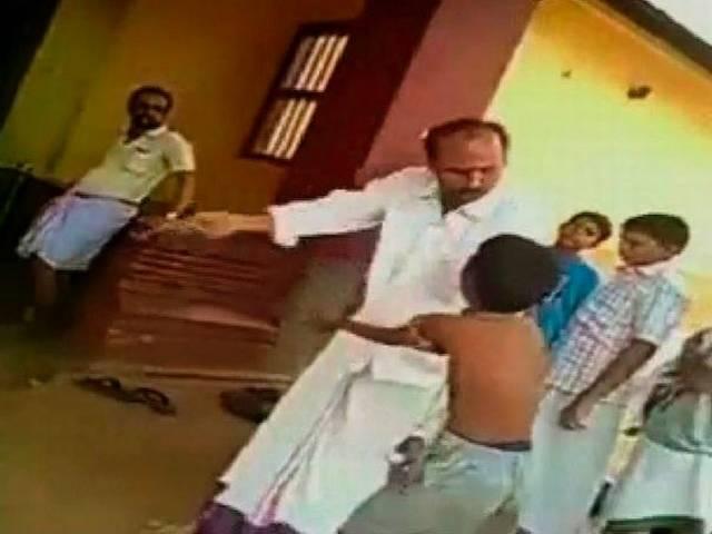 शिक्षक द्वारा लड़के को पीटने का वीडियो वायरल Teacher thrashes young boy with fractured hand