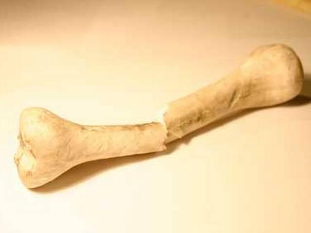 हड्डियों के घाव जल्द भरेगी ये नई दवा New drug could help bones heal better, faster