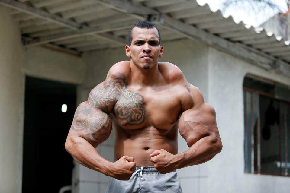 Brazilian bodybuilder Romario injects mineral oil into muscles to get Hulk like physique