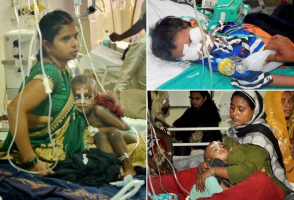 BLOG: बच्चों की मौत पर राजनीति के बजाय समग्र स्वास्थ्य नीति बनाए योगी सरकार