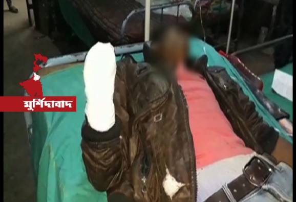 বোনকে উত্যক্ত করার প্রতিবাদ, দাদার হাত কেটে নিল দুষ্কৃতী!