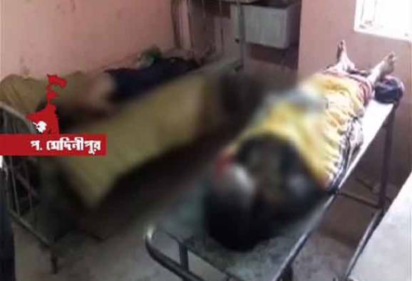 পারিবারিক বিবাদে ভাইপো-ভাইঝিকে পুড়িয়ে ‘খুন’, আশঙ্কাজনক শিশুদের মা, অভিযুক্ত কাকা পলাতক