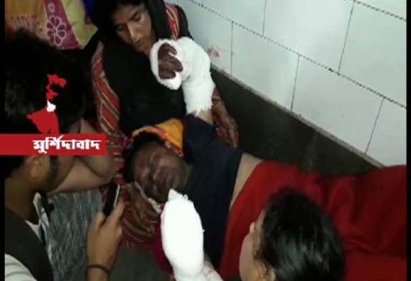 মুর্শিদাবাদের রেজিনগরে বোমা বাঁধতে গিয়ে মৃত্যু একজনের ,জখম পঞ্চায়েত সমিতির তৃণমূল প্রার্থী-সহ ২