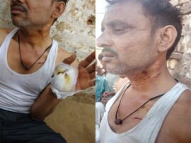 wild animal attacked farmer in agra admitted to hospital जंगली जानवर ने किसान पर बोला हमला, किया लहूलुहान; अस्पताल में भर्ती