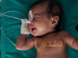 Everybody surprised when fetus found in baby stomach एक महीने की बच्ची के पेट में था ट्यूमर...ऑपरेशन के बाद डॉक्टर ने जो देखा रह गए हैरान