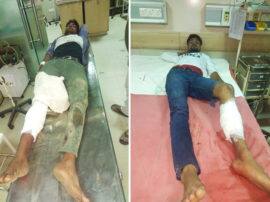 प्रॉपर्टी डीलर की हत्या करने की फिराक में थे ये दो शातिर शूटर, पुलिस ने ऐसे प्लानिंग की फेल Noida police arrested two shooters Akash and Ravi during encounter प्रॉपर्टी डीलर की हत्या करने की फिराक में थे ये दो शातिर शूटर, पुलिस ने ऐसे प्लानिंग की फेल