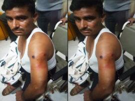 ग्रेटर नोएडा में BJP कार्यकर्ता को गोली मारकर बदमाश फरार, पुलिस जांच में जुटी Attack on BJP worker in greater noida police investigation goes on ग्रेटर नोएडा में BJP कार्यकर्ता को गोली मारकर बदमाश फरार, पुलिस जांच में जुटी