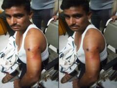 ग्रेटर नोएडा में BJP कार्यकर्ता को गोली मारकर बदमाश फरार, पुलिस जांच में जुटी