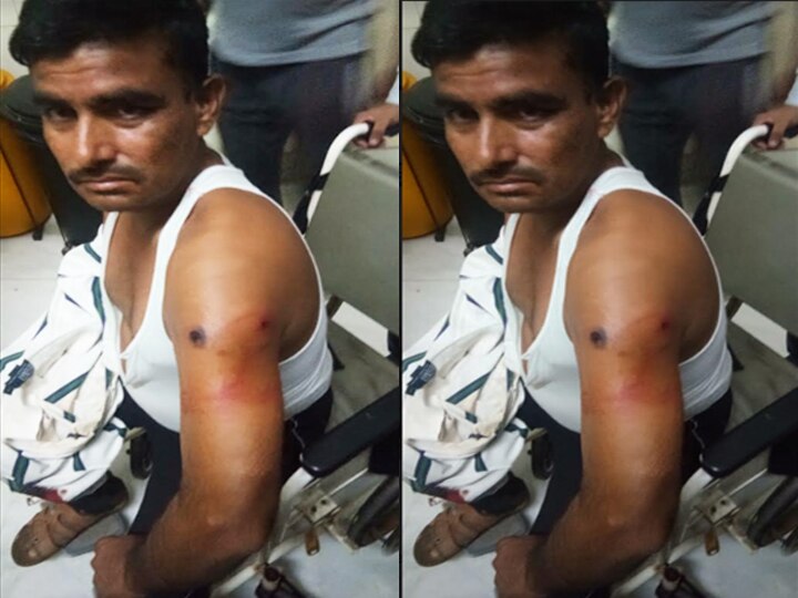 ग्रेटर नोएडा में BJP कार्यकर्ता को गोली मारकर बदमाश फरार, पुलिस जांच में जुटी Attack on BJP worker in greater noida police investigation goes on