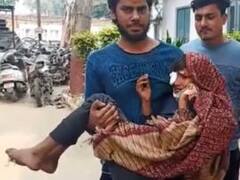 खेल-खेल में हुआ विवाद तो महिला ने फोड़ दी बच्चे की आंख Meerut News