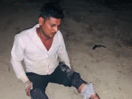 डीजल चुरा रहे बदमाशों की पुलिस से मुठभेड़, एक घायल; तीन फरार one criminal injured in encounter in greater noida डीजल चुरा रहे बदमाशों की पुलिस से मुठभेड़, एक घायल; तीन फरार